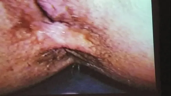 New Close up anal total Tube